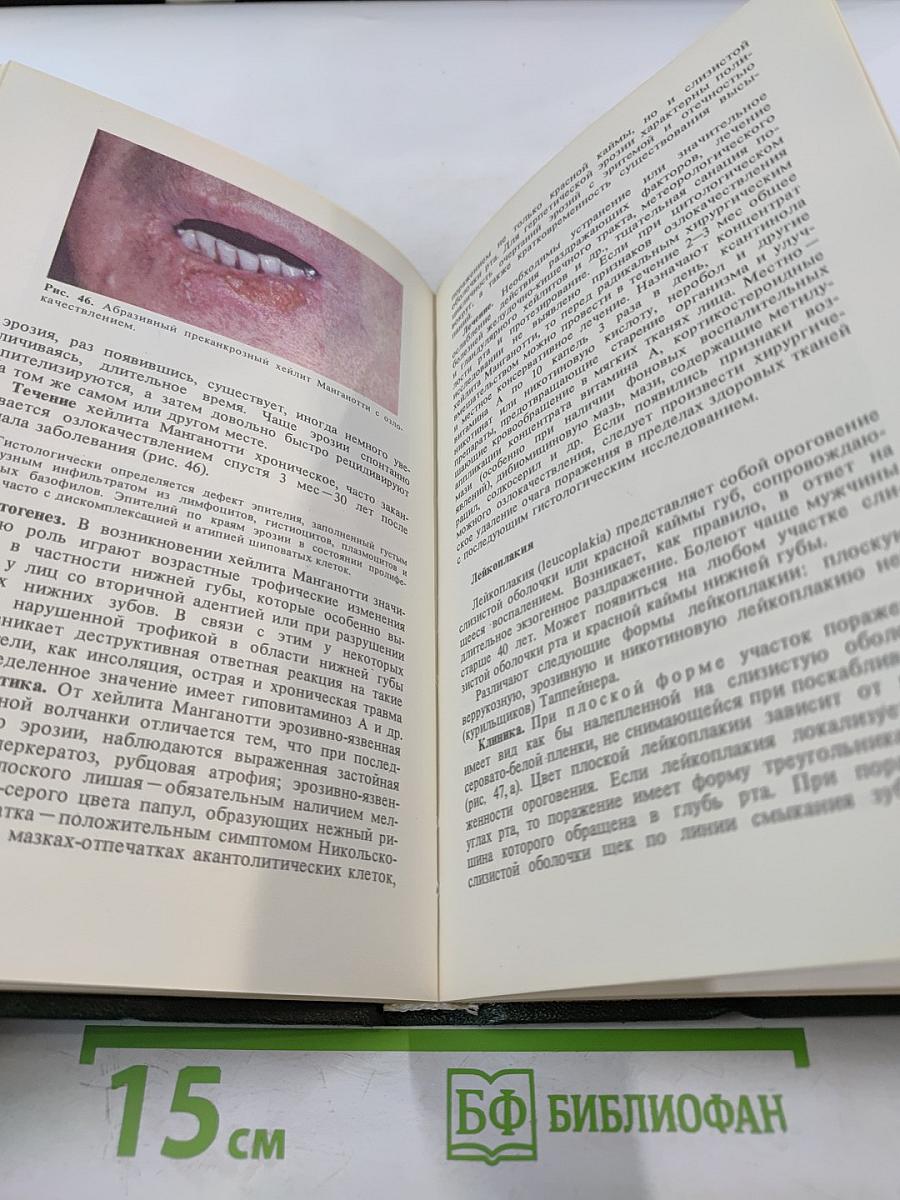 Кожные и венерические болезни