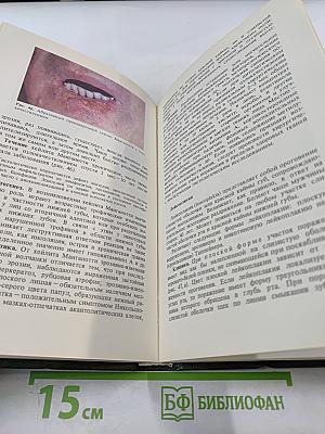 Кожные и венерические болезни