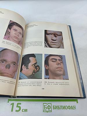 Болезни уха, горла и носа. Атлас