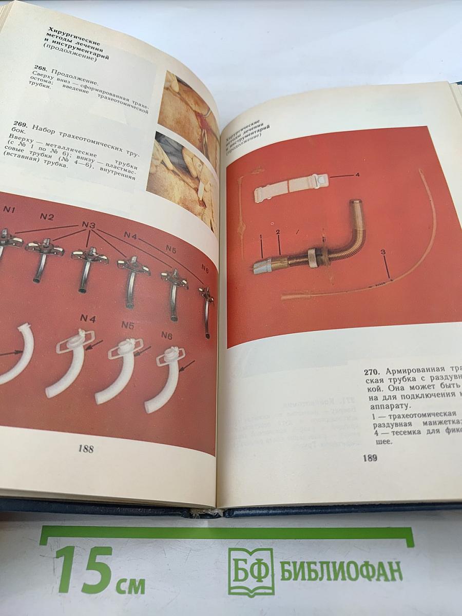 Болезни уха, горла и носа. Атлас