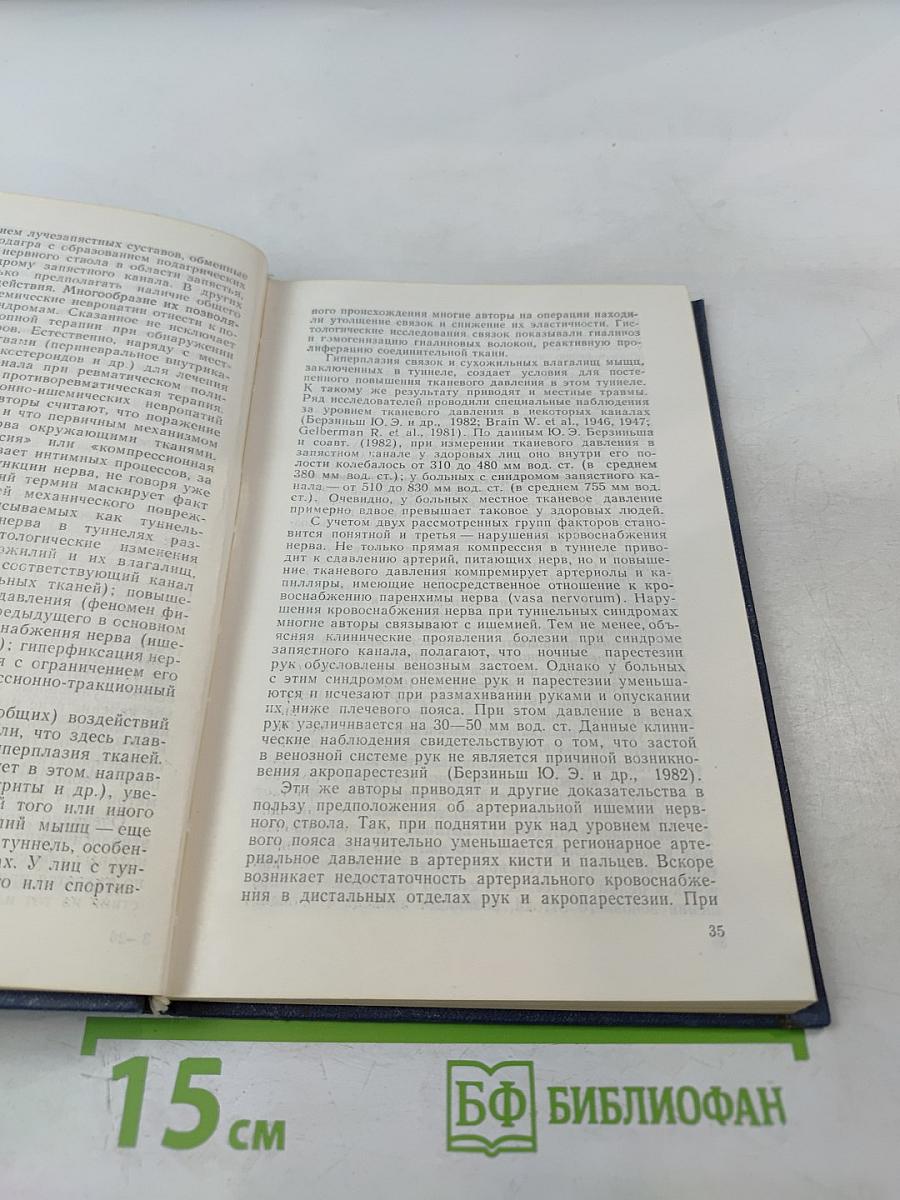 Туннельные компрессионно-ишемические невропатии