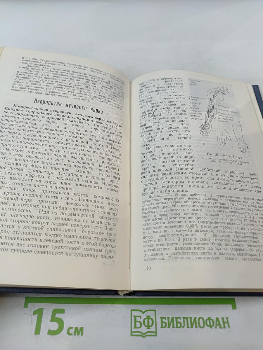 Туннельные компрессионно-ишемические невропатии