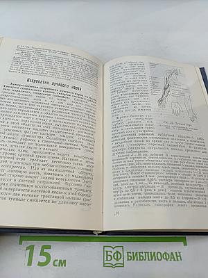 Туннельные компрессионно-ишемические невропатии