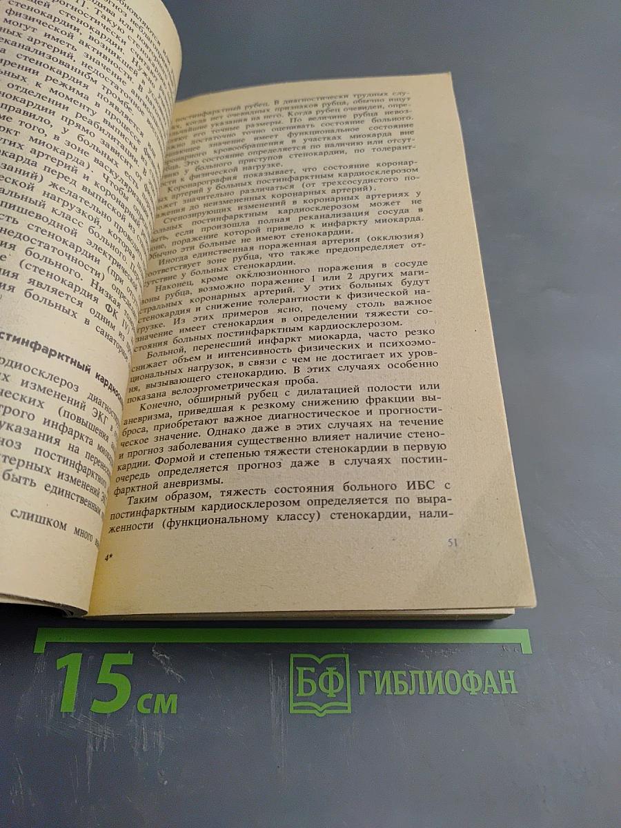 Стенокардия