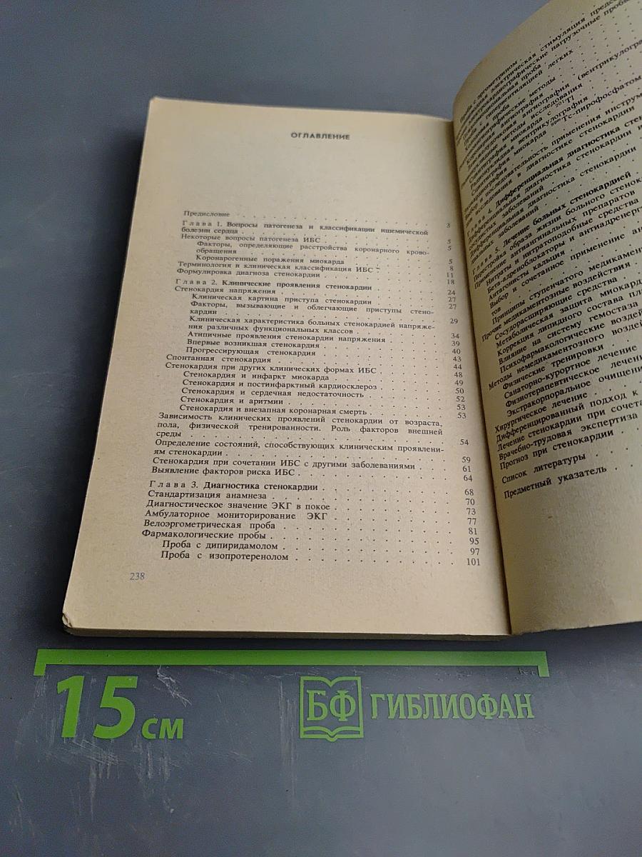 Стенокардия