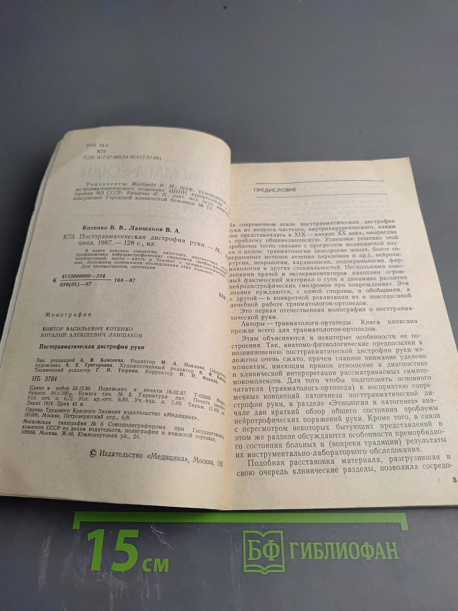 Посттравматическая дистрофия руки