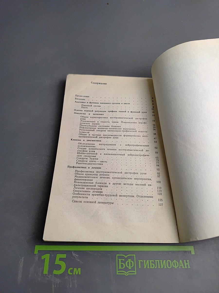 Посттравматическая дистрофия руки