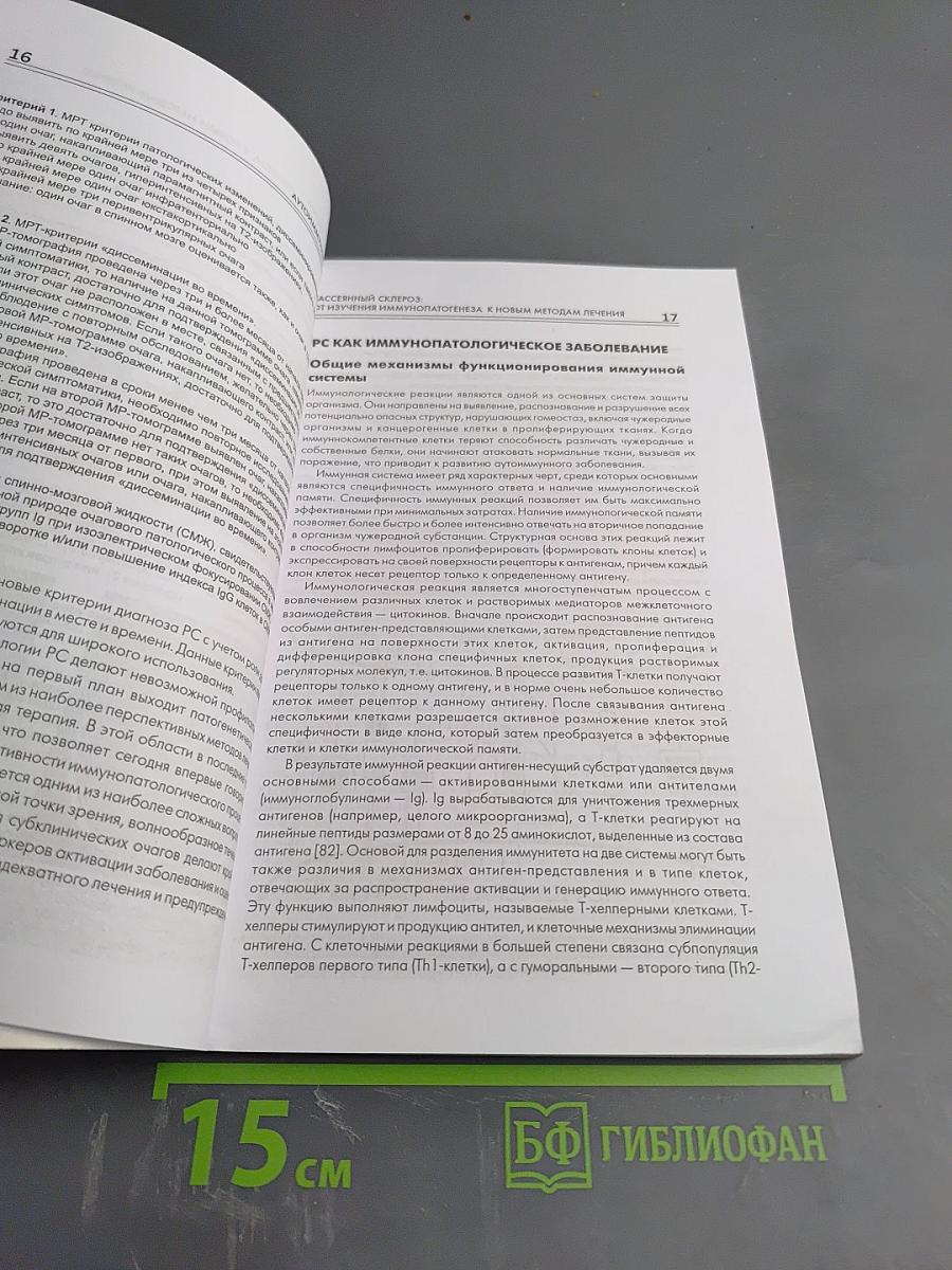 Рассеянный склероз: от изучения иммунопатогенеза к новым методам лечения