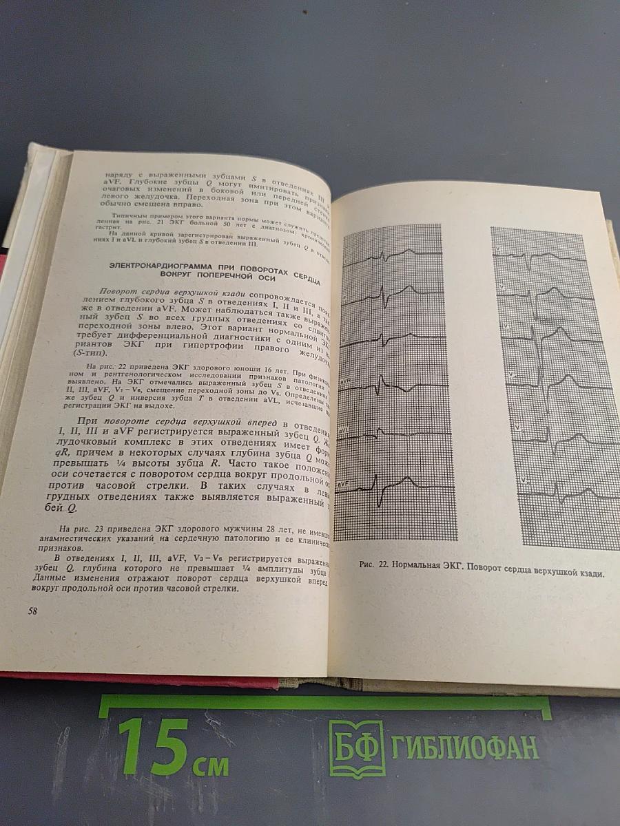 Практическая электрокардиография