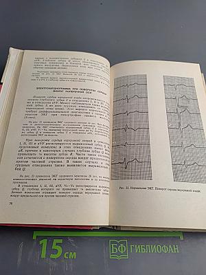 Практическая электрокардиография
