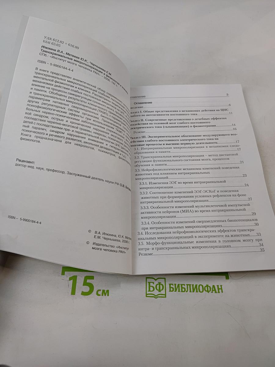 Транскраниальная микрополяризация в физиологии и клинике (К 15-летию Института мозга человека РАН)