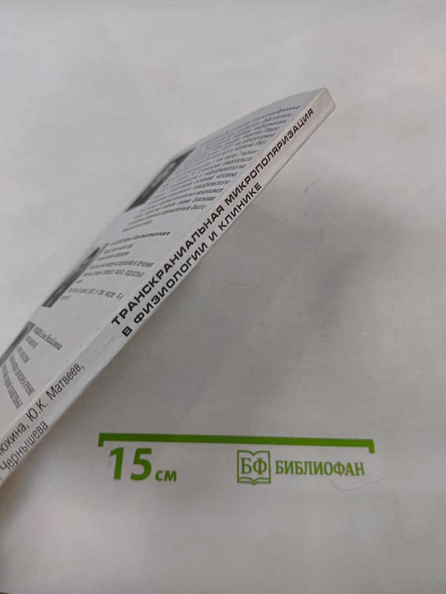 Транскраниальная микрополяризация в физиологии и клинике (К 15-летию Института мозга человека РАН)