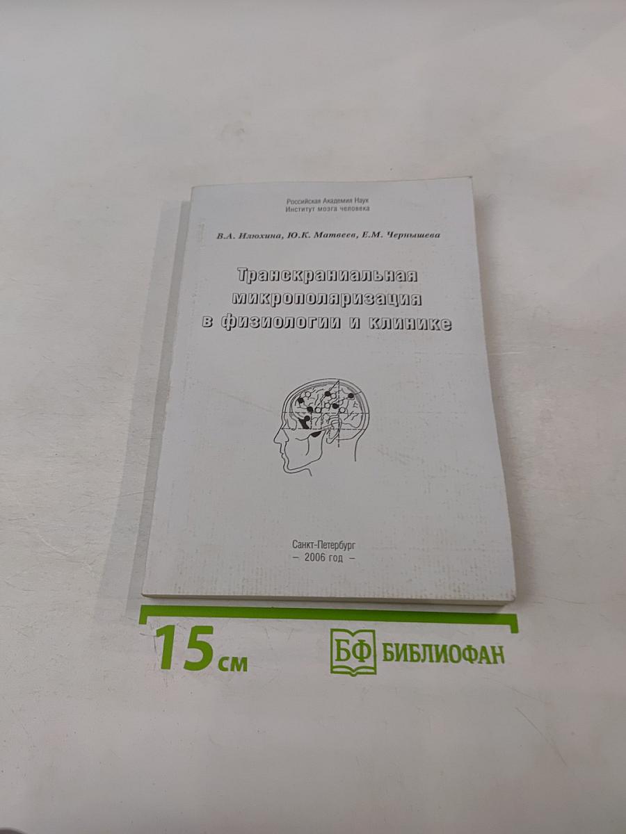 Транскраниальная микрополяризация в физиологии и клинике