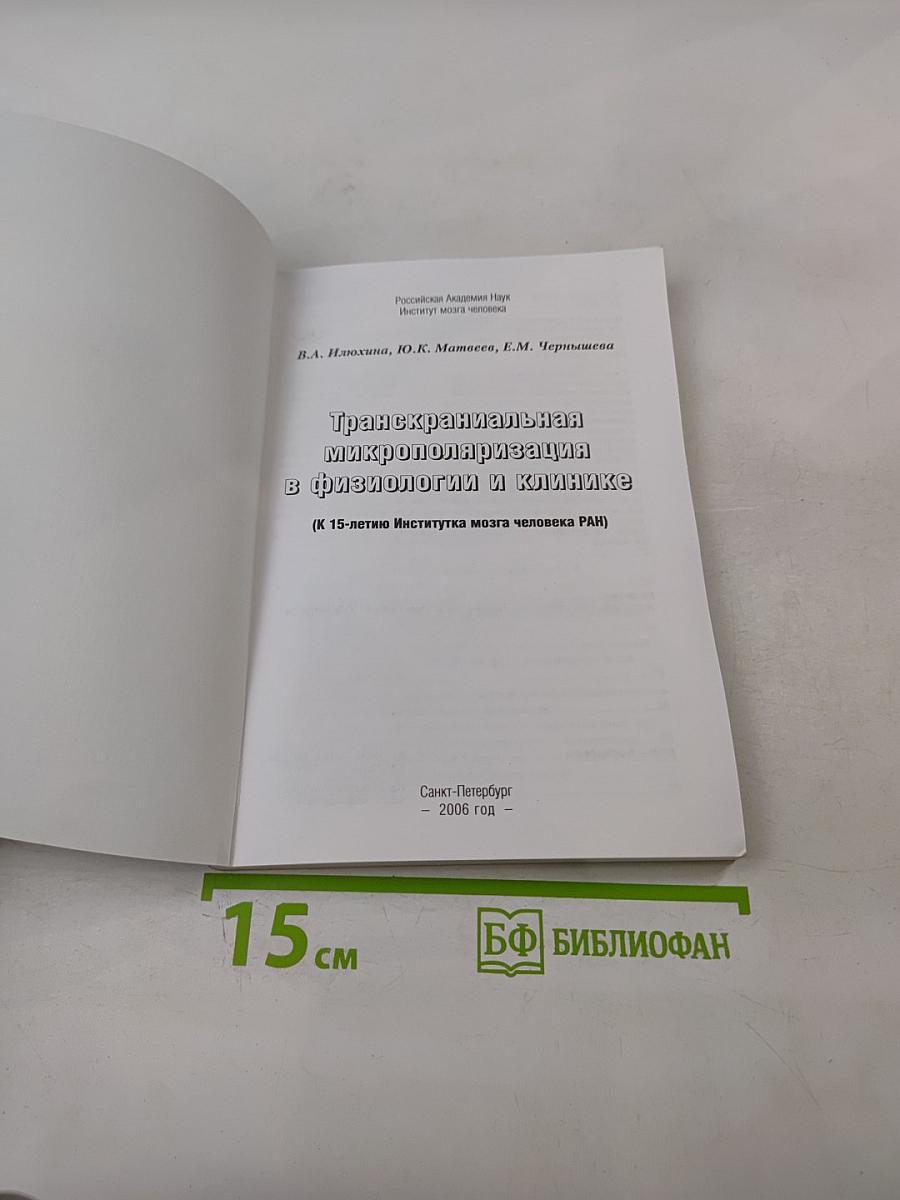 Транскраниальная микрополяризация в физиологии и клинике