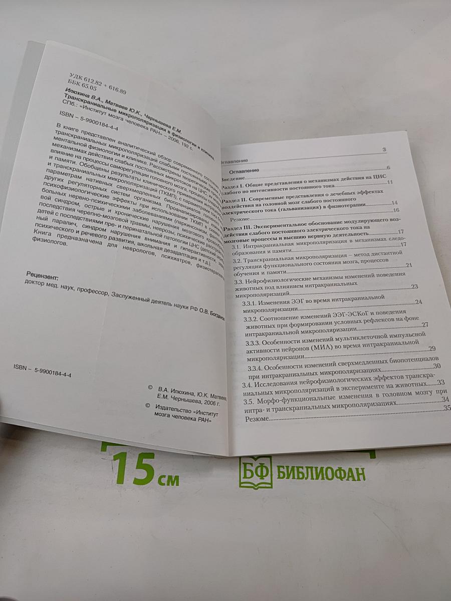 Транскраниальная микрополяризация в физиологии и клинике