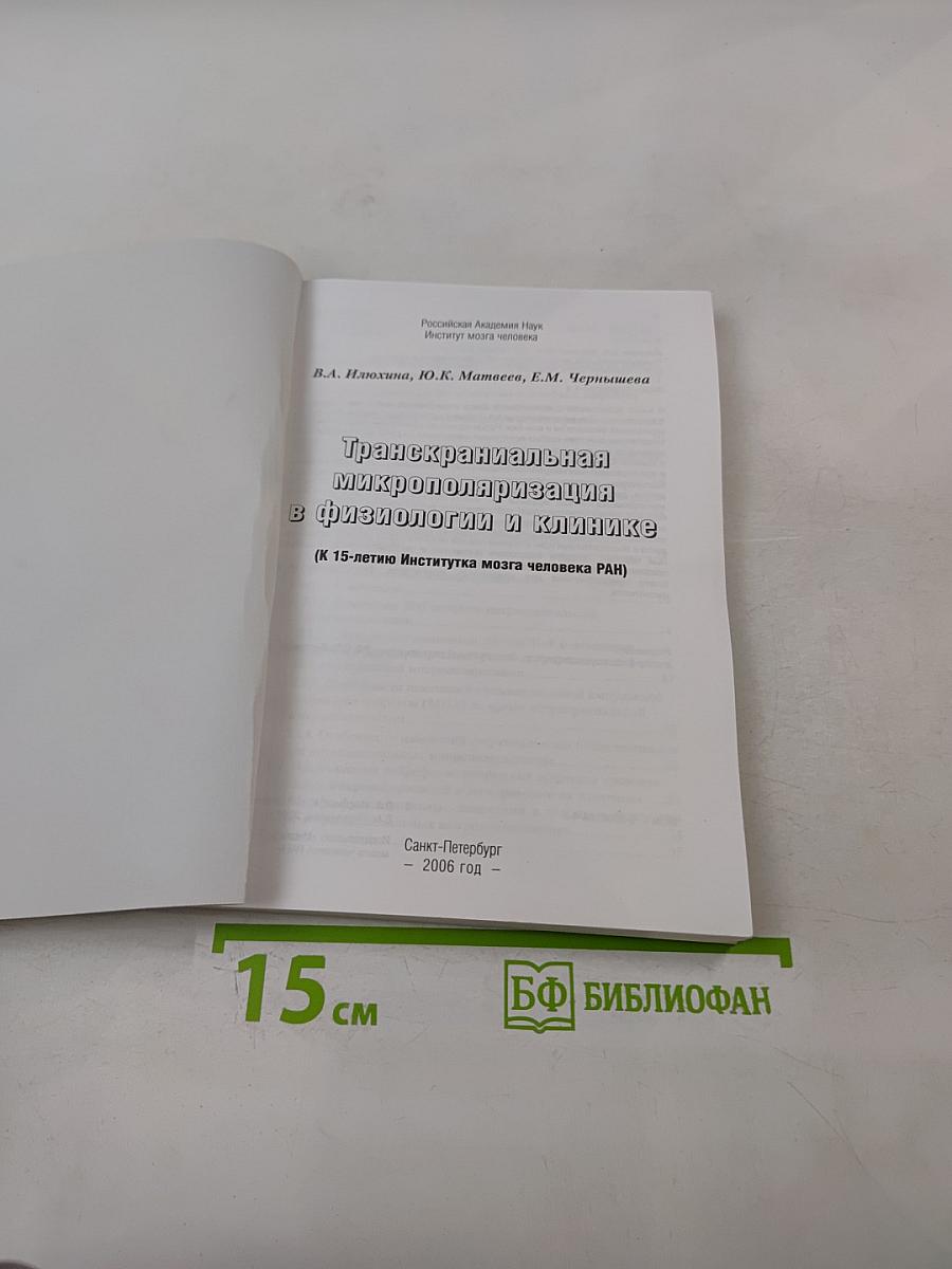 Транскраниальная микрополяризация в физиологии и клинике