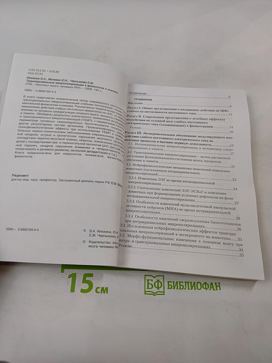 Транскраниальная микрополяризация в физиологии и клинике