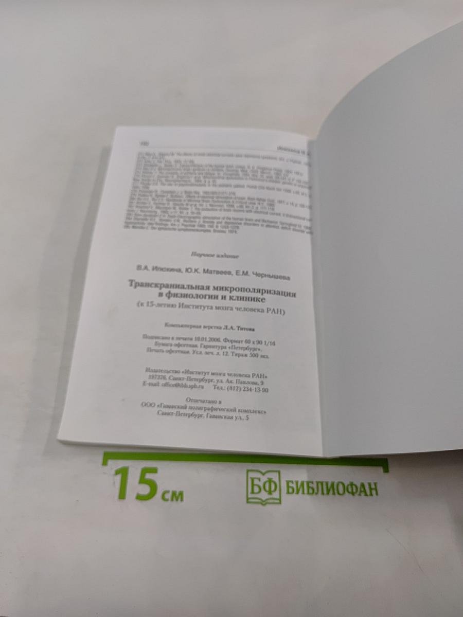 Транскраниальная микрополяризация в физиологии и клинике