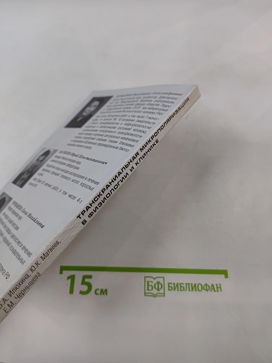 Транскраниальная микрополяризация в физиологии и клинике