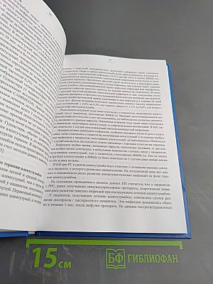 Рассеянный склероз. Моноклональная терапия