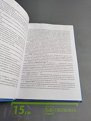 Рассеянный склероз. Моноклональная терапия