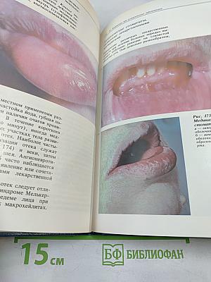 Атлас заболеваний слизистой оболочки рта