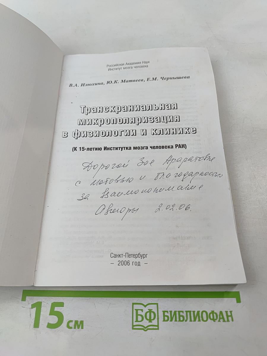 Транскраниальная микрополяризация в физиологии и клинике