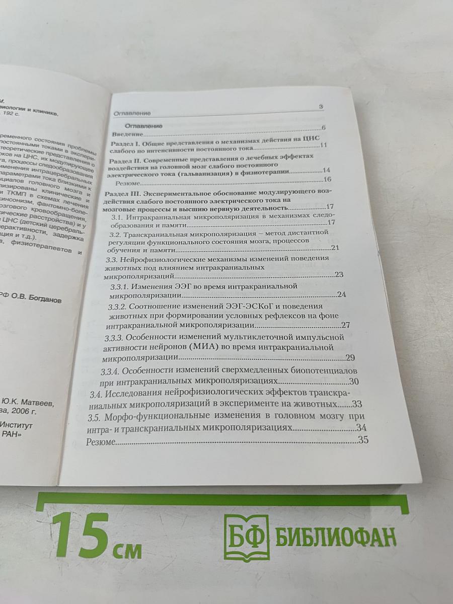 Транскраниальная микрополяризация в физиологии и клинике