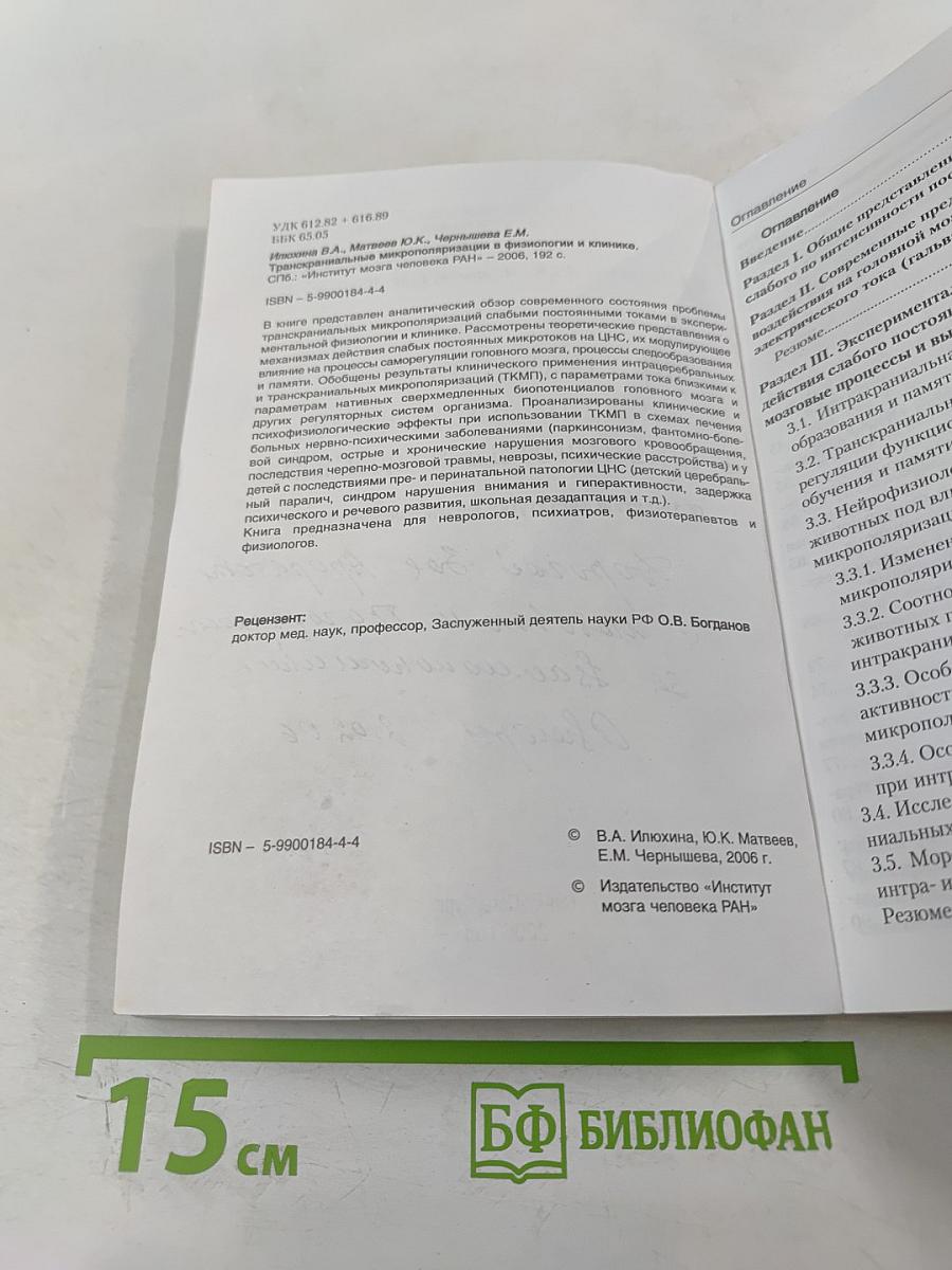 Транскраниальная микрополяризация в физиологии и клинике