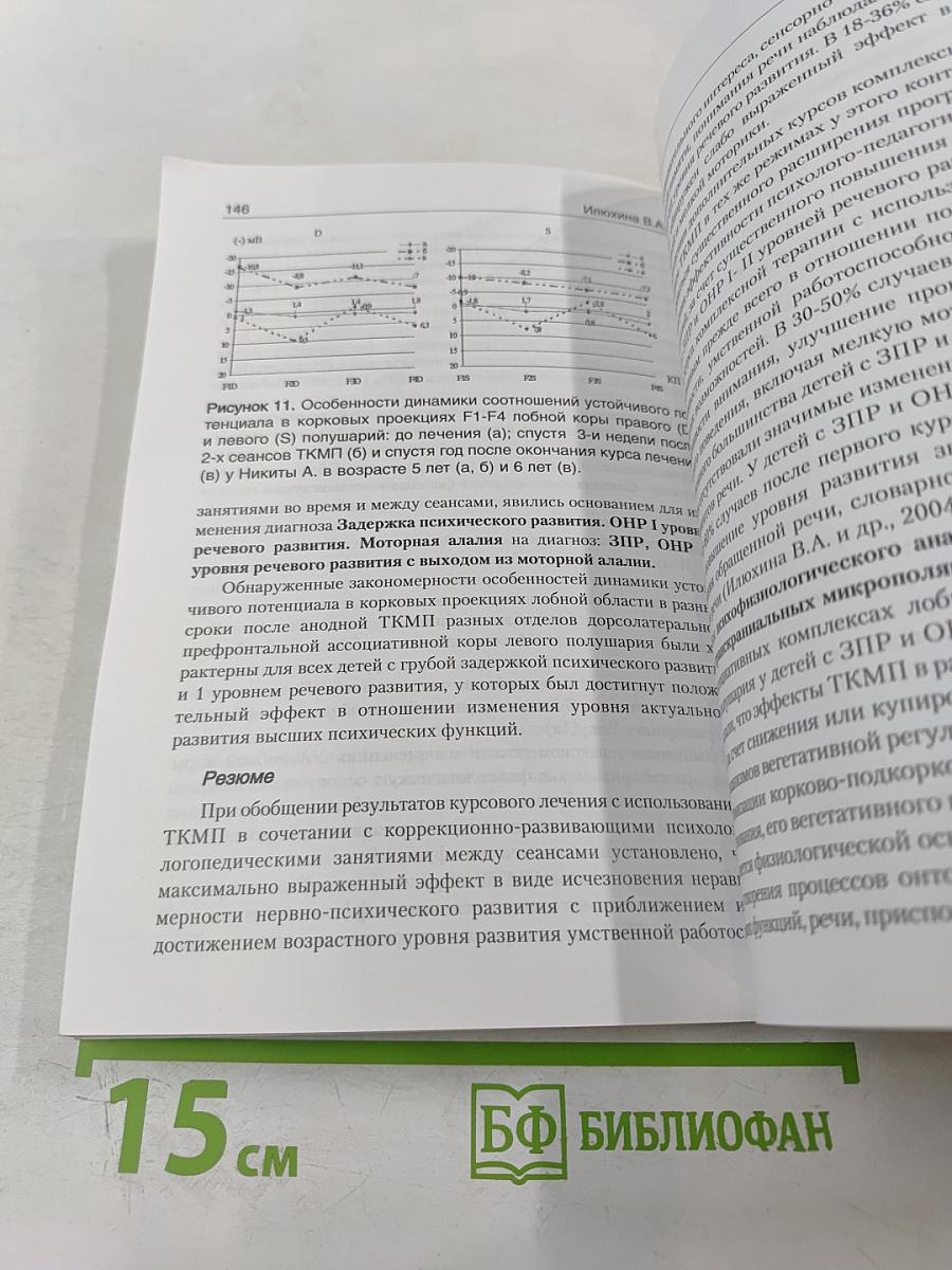 Транскраниальная микрополяризация в физиологии и клинике