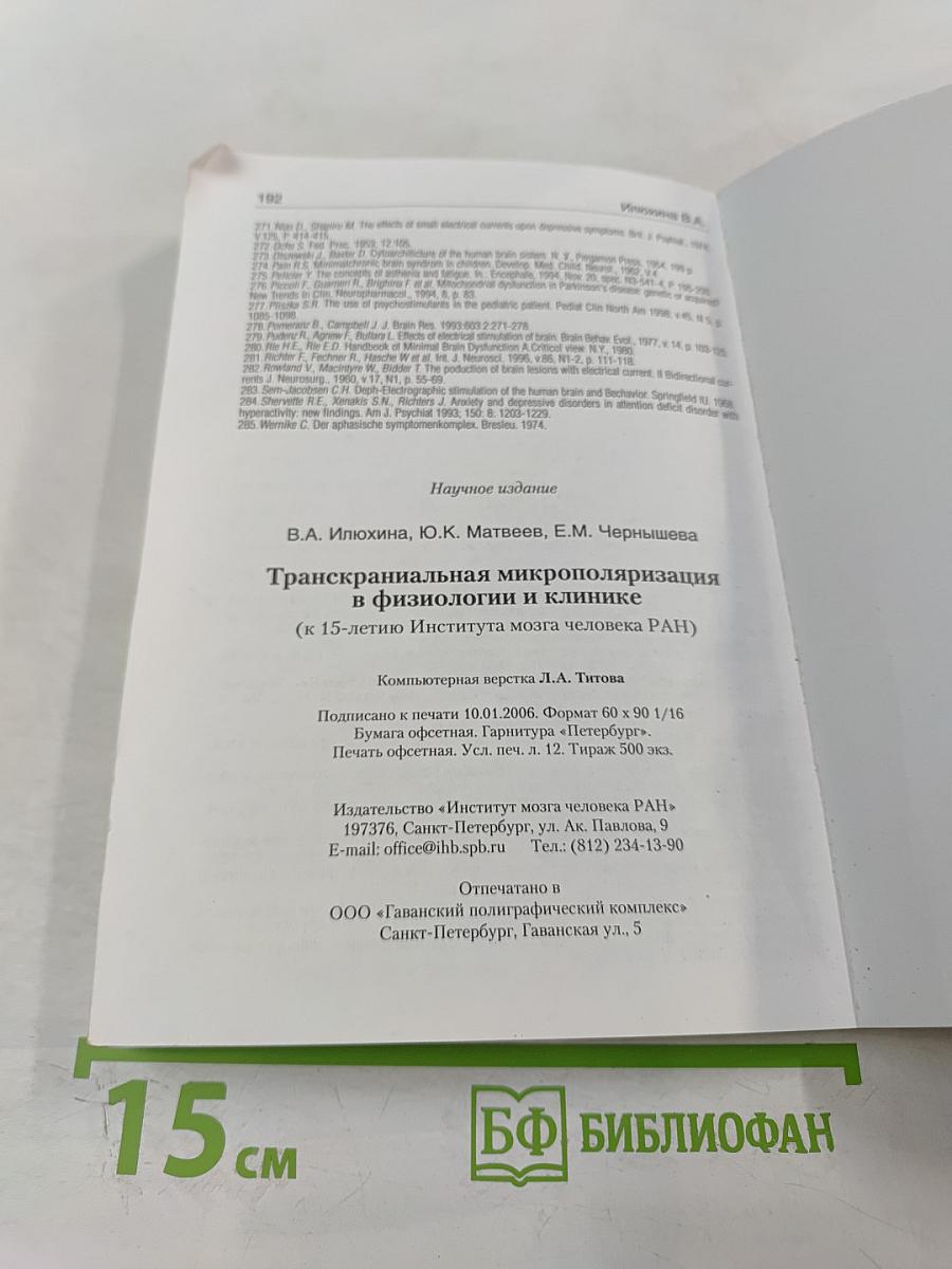 Транскраниальная микрополяризация в физиологии и клинике