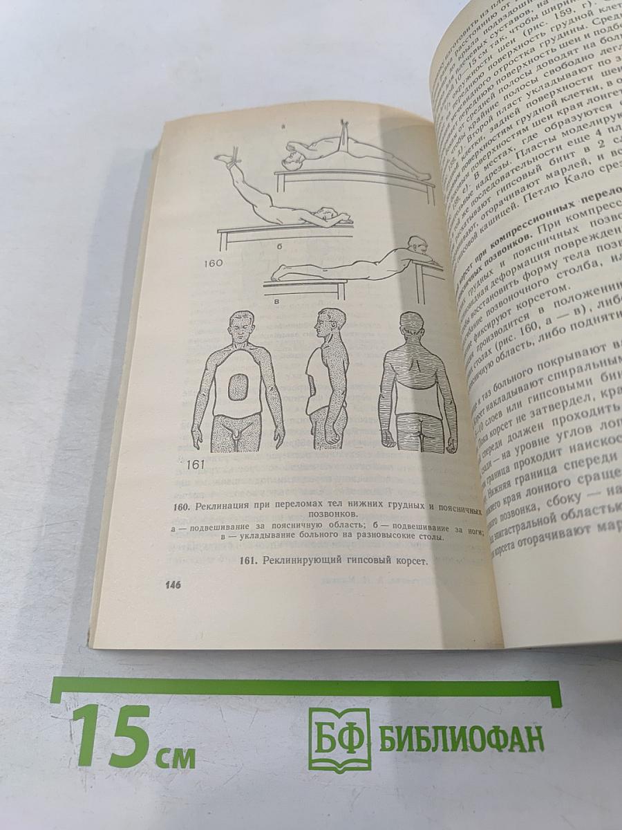 Гипсовая техника