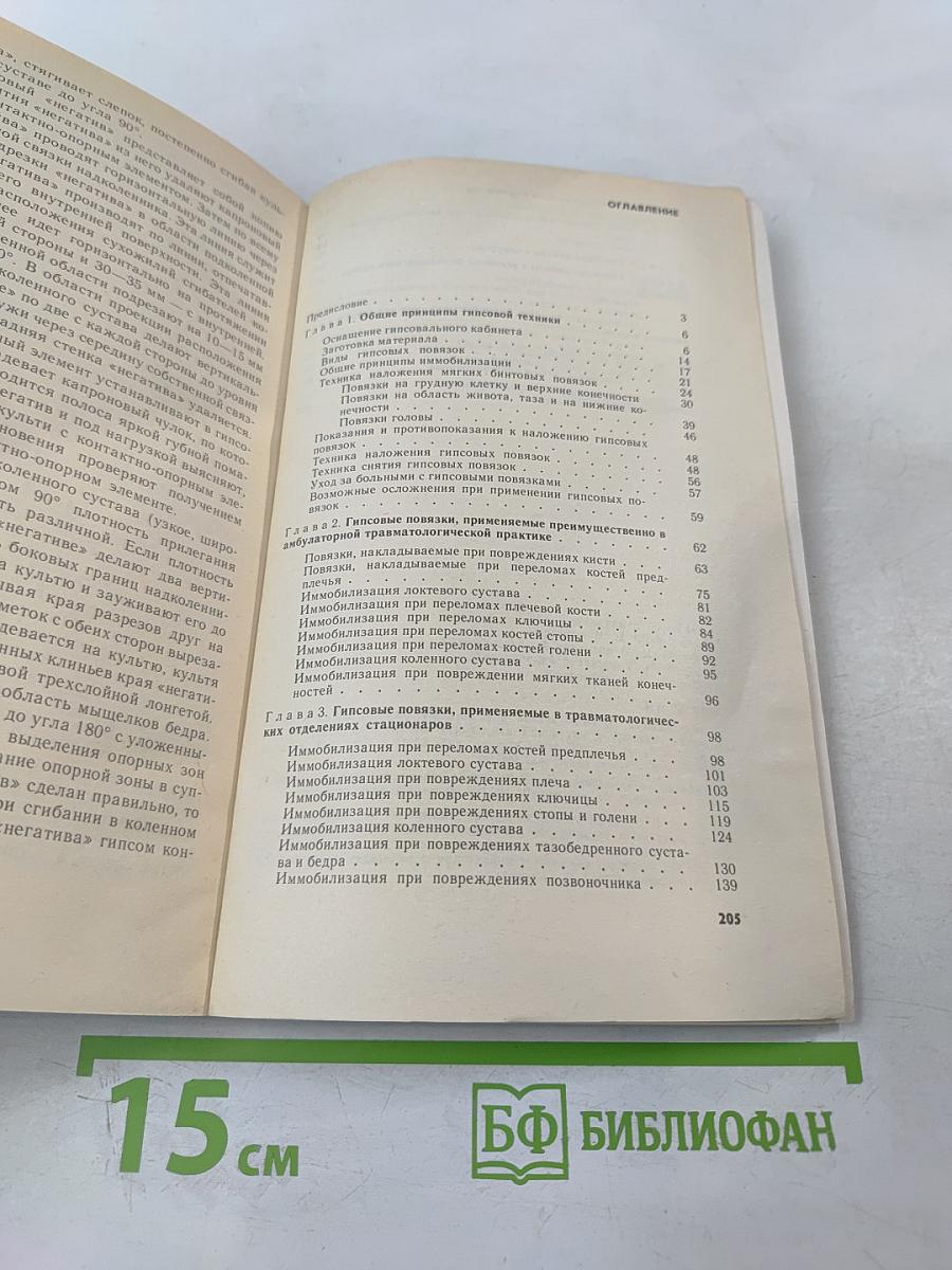 Гипсовая техника