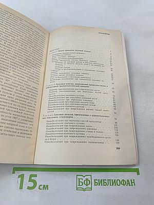 Гипсовая техника