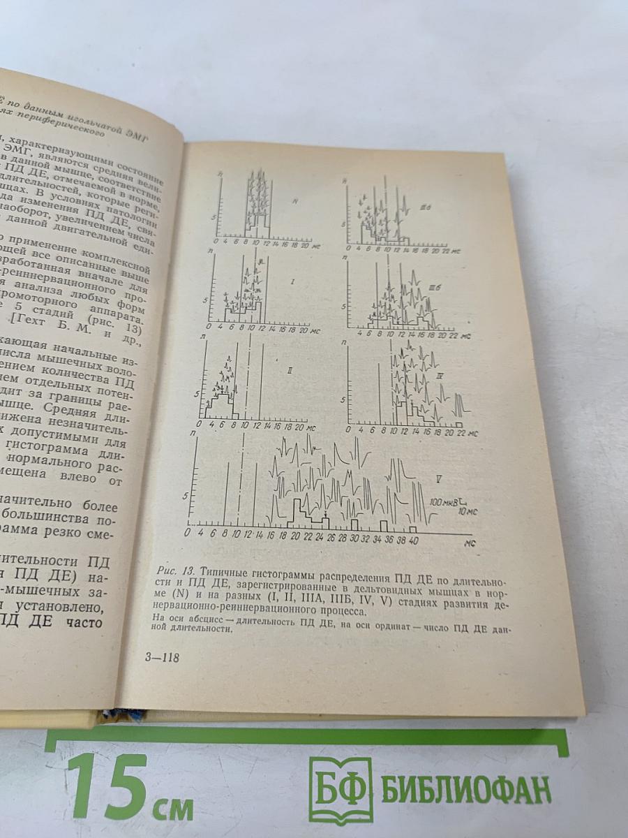 Нервно-мышечные болезни