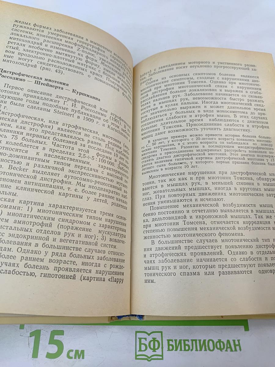 Нервно-мышечные болезни