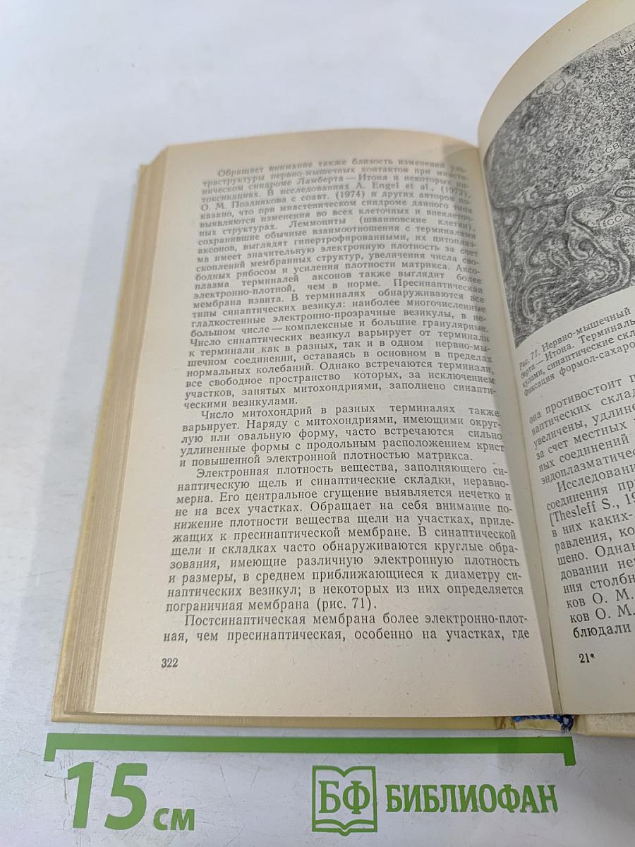 Нервно-мышечные болезни