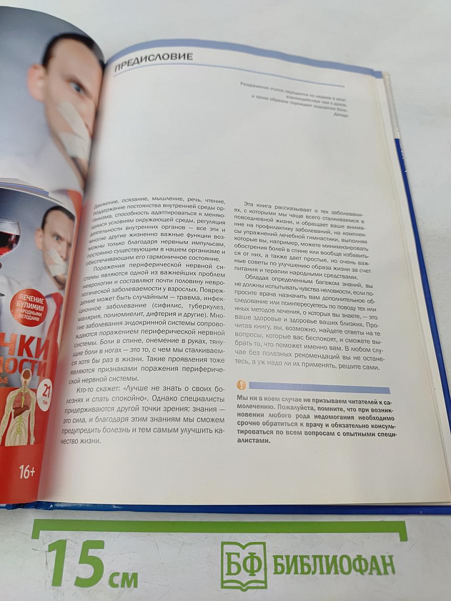 Крепкие нервы. Периферическая нервная система