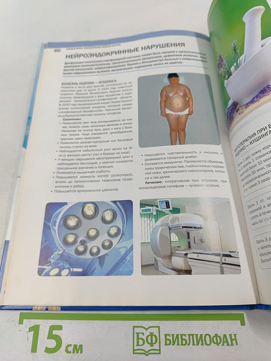 Крепкие нервы. Периферическая нервная система