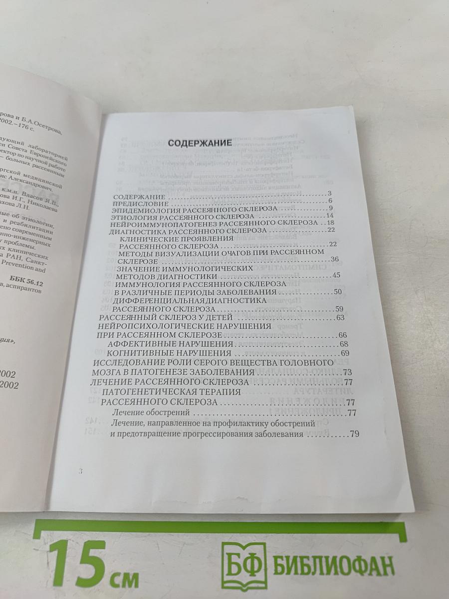 Рассеянный склероз