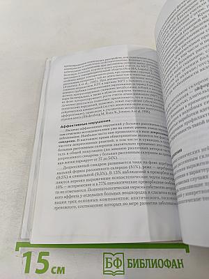 Рассеянный склероз