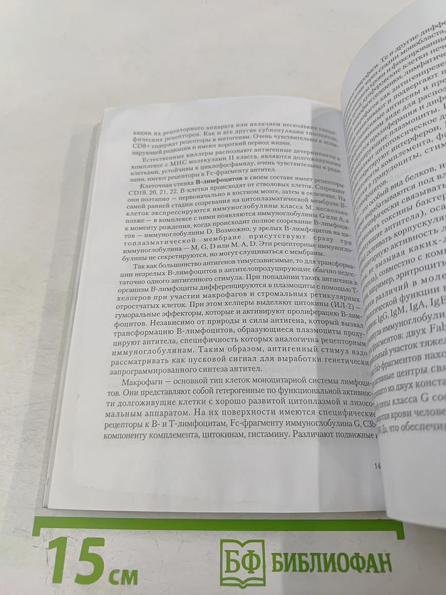 Рассеянный склероз