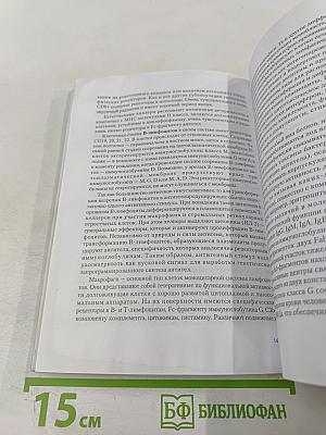 Рассеянный склероз