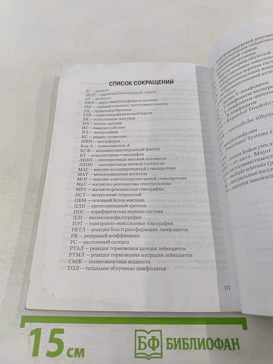 Рассеянный склероз