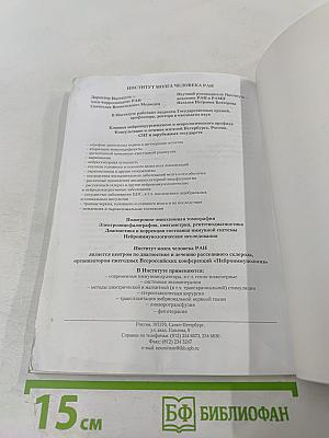 Рассеянный склероз