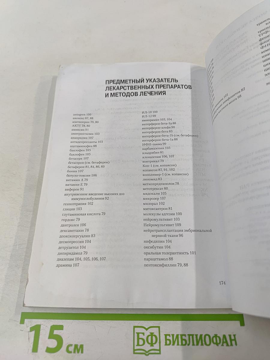 Рассеянный склероз