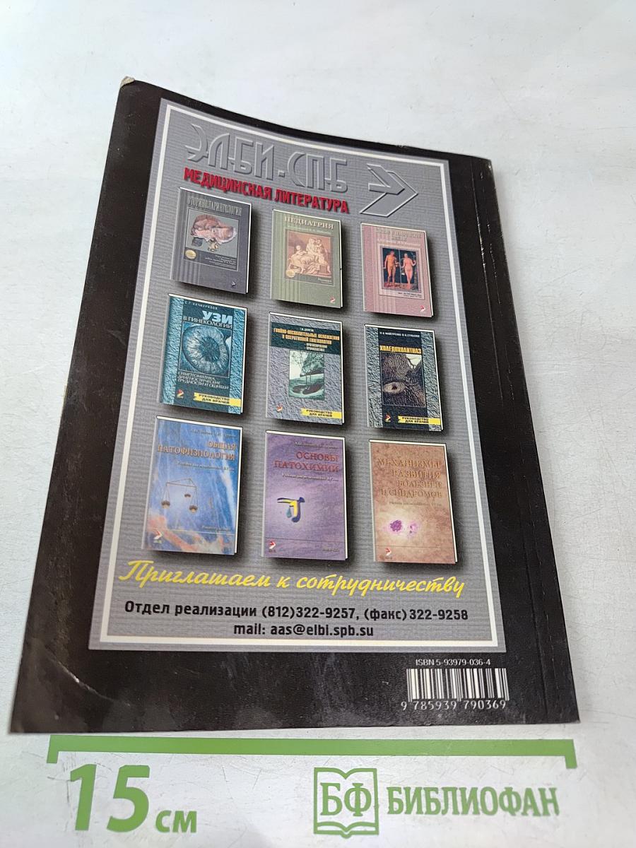 Рассеянный склероз