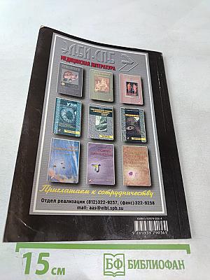 Рассеянный склероз