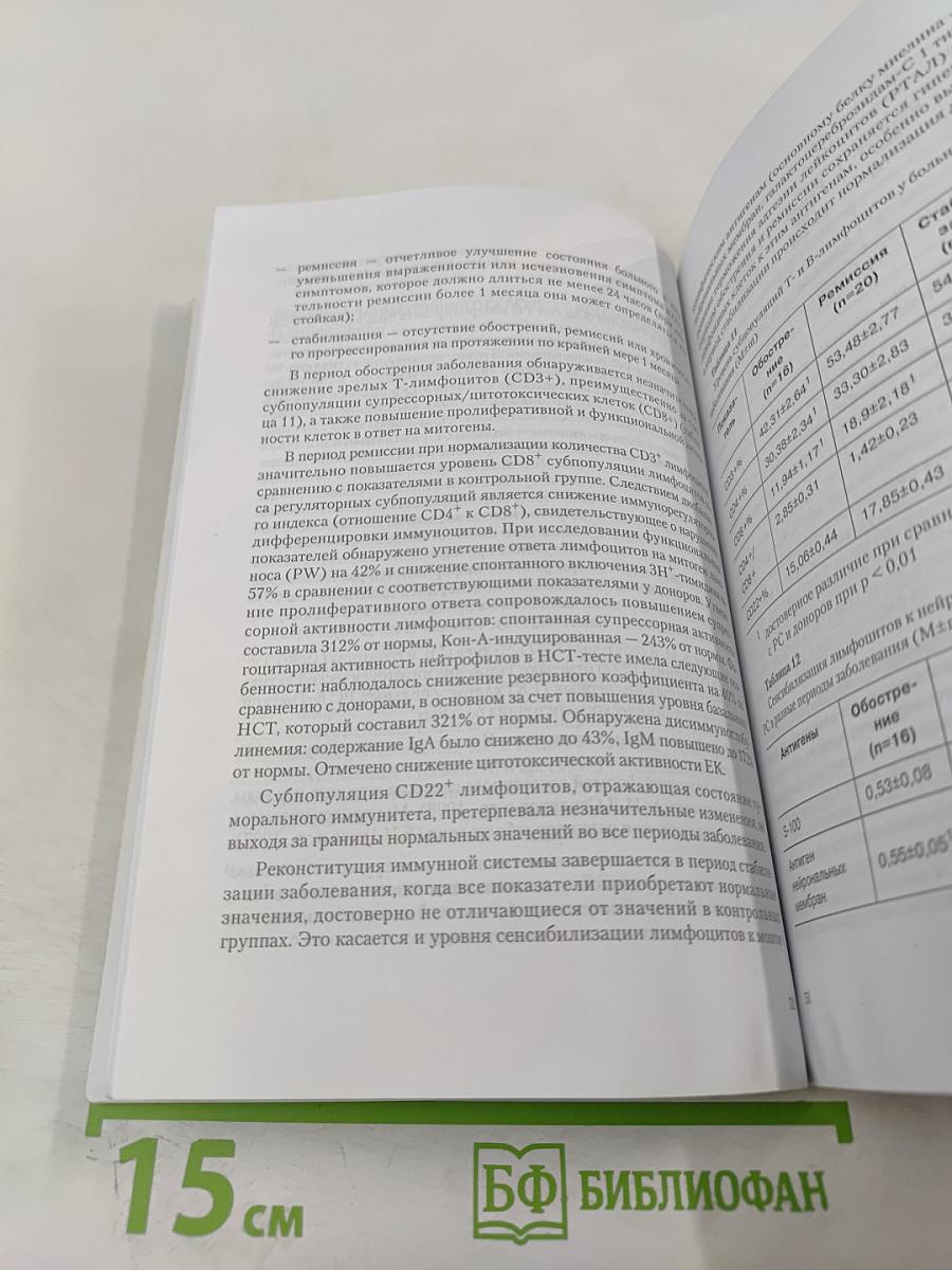 Рассеянный склероз