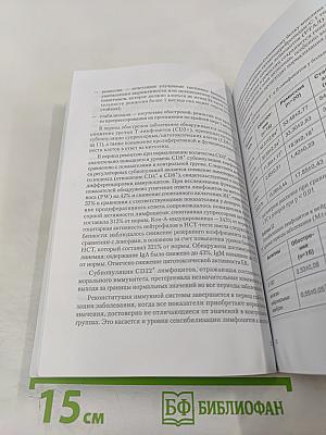 Рассеянный склероз